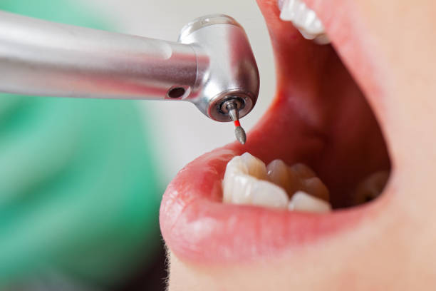 Best Urgent Dental Care for Toothache in Richmond, UT